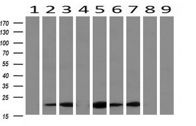 RBP1 Antibody in Western Blot (WB)