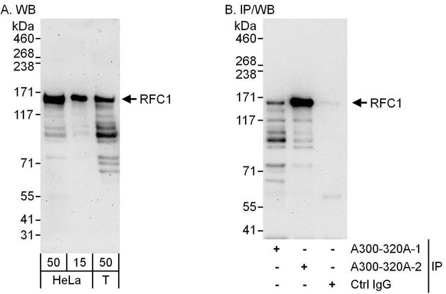 RFC1 Antibody in Western Blot (WB)