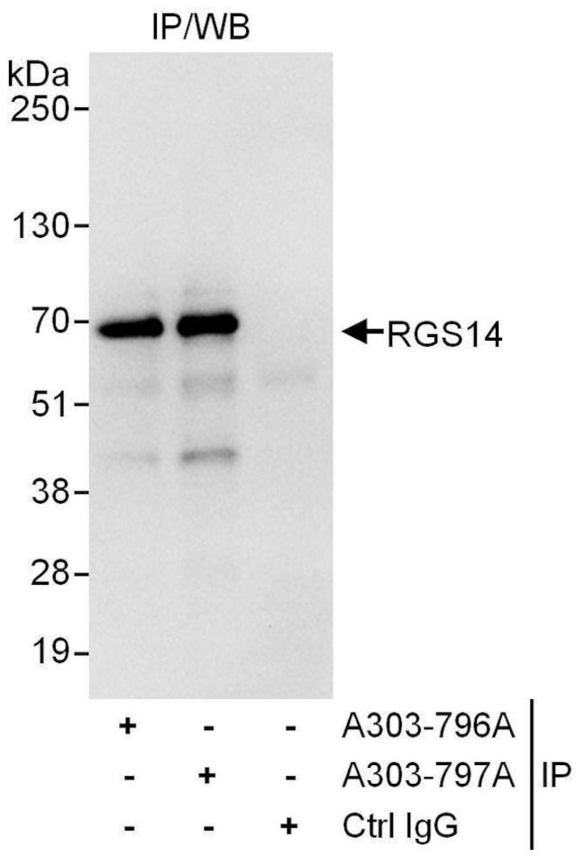 RGS14 Antibody in Immunoprecipitation (IP)