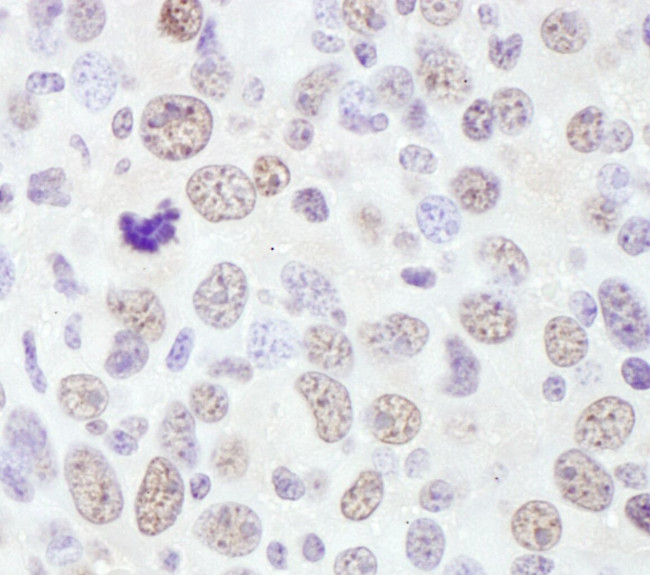 RNF138 Antibody in Immunohistochemistry (IHC)