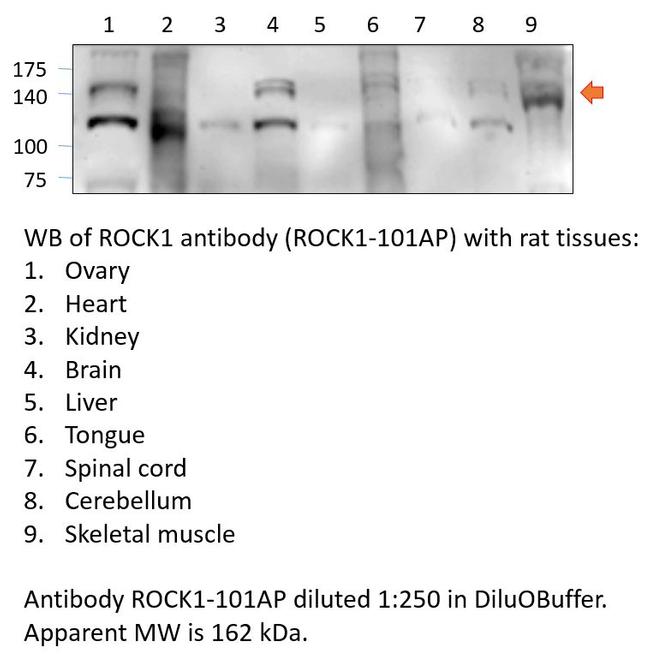 ROCK1 Antibody in Western Blot (WB)