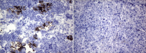 ROS1 Antibody in Immunohistochemistry (Paraffin) (IHC (P))