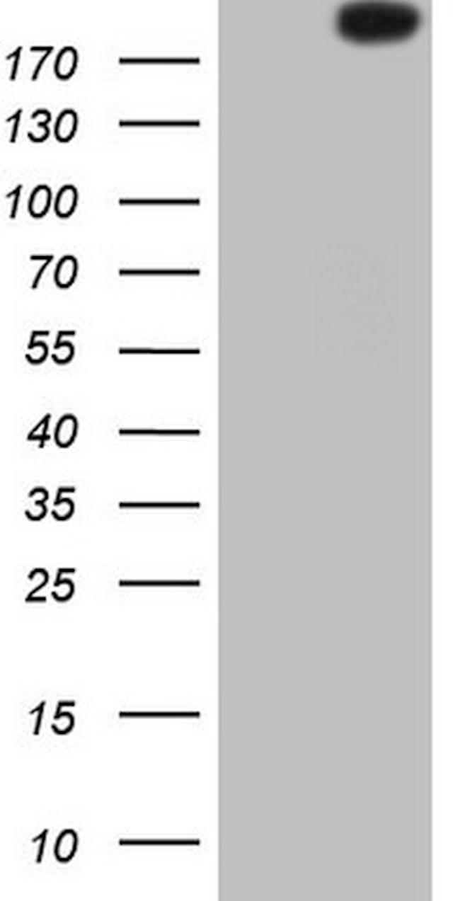 ROS1 Antibody in Western Blot (WB)