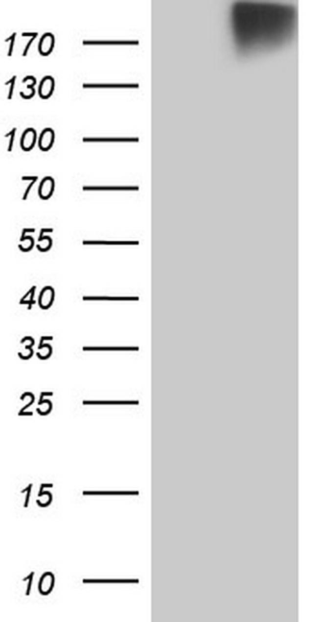 ROS1 Antibody in Western Blot (WB)