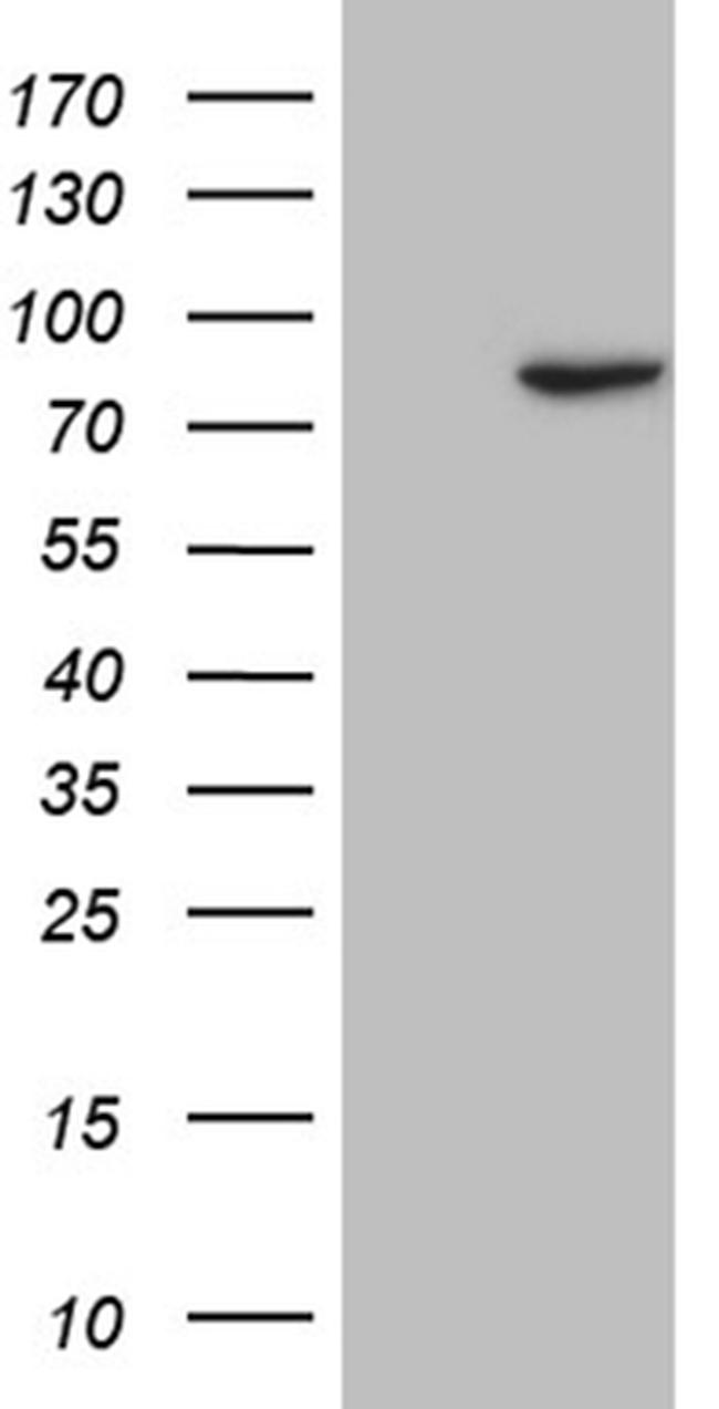 RPS6KA2 Antibody in Western Blot (WB)