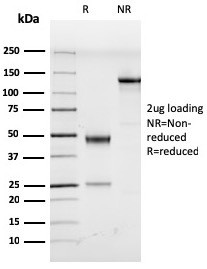 Human Herpes Virus 8 (HHV8) Antibody in SDS-PAGE (SDS-PAGE)