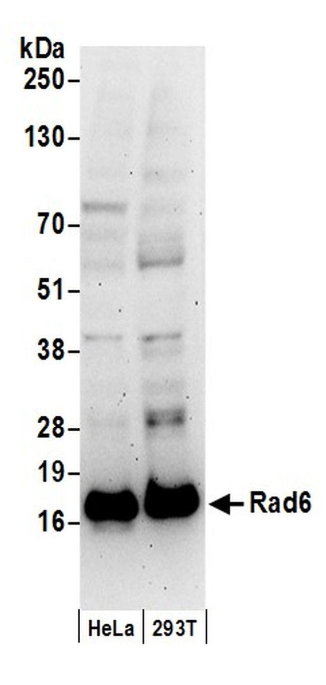Rad6 Antibody in Western Blot (WB)