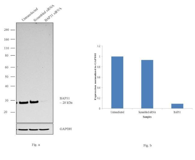 Rat IgG (H+L) Secondary Antibody in Western Blot (WB)