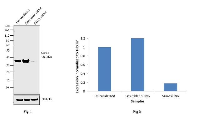 Rat IgG (H+L) Secondary Antibody in Western Blot (WB)