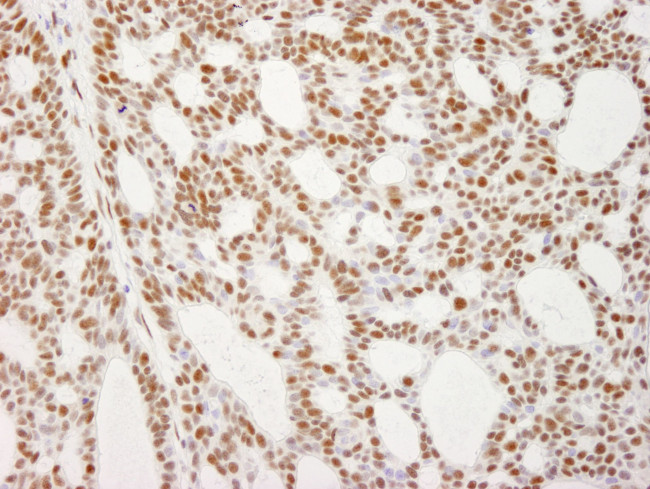 RecQ1 Antibody in Immunohistochemistry (IHC)