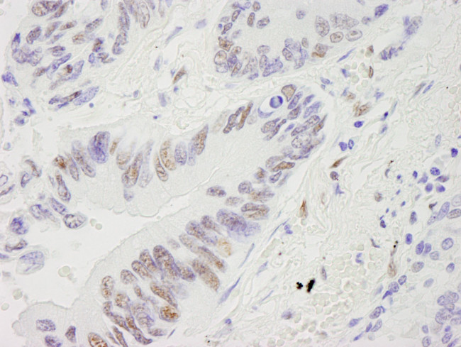 RecQ1 Antibody in Immunohistochemistry (IHC)