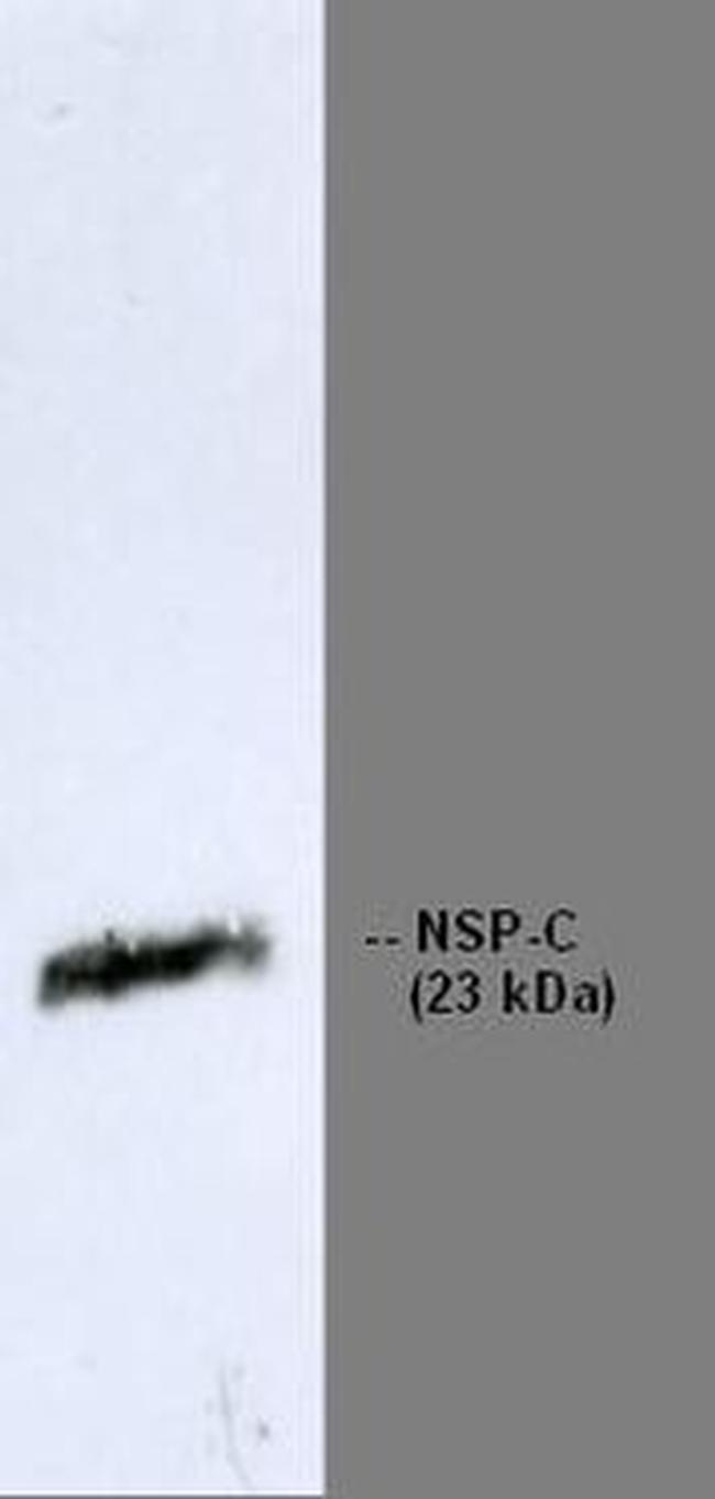 RTN1 Antibody in Western Blot (WB)