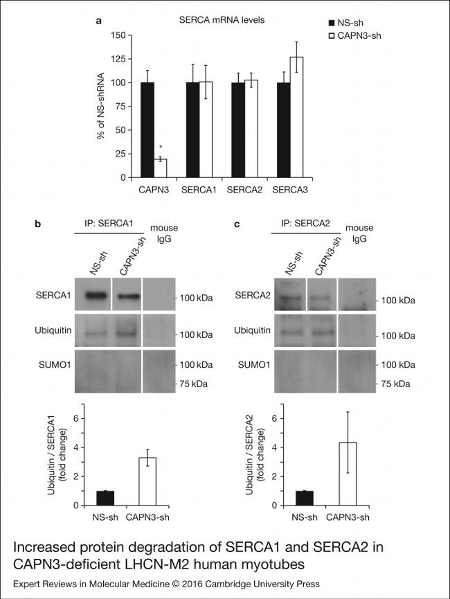 SERCA1 ATPase Antibody in Western Blot, Immunoprecipitation (WB, IP)