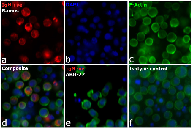 Human IgM Cross-Adsorbed Secondary Antibody in Immunocytochemistry (ICC/IF)