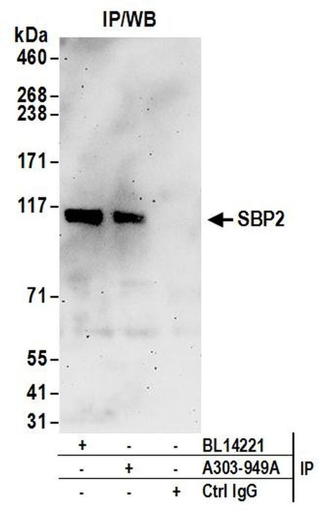 SBP2 Antibody in Western Blot (WB)