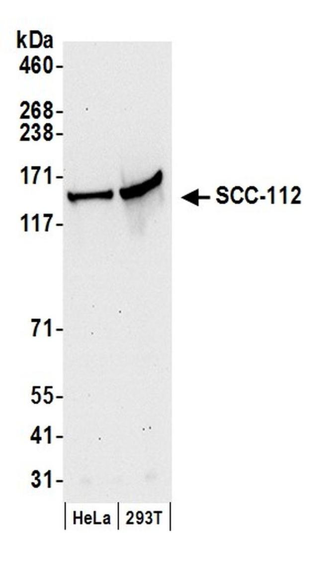 SCC-112 Antibody in Western Blot (WB)
