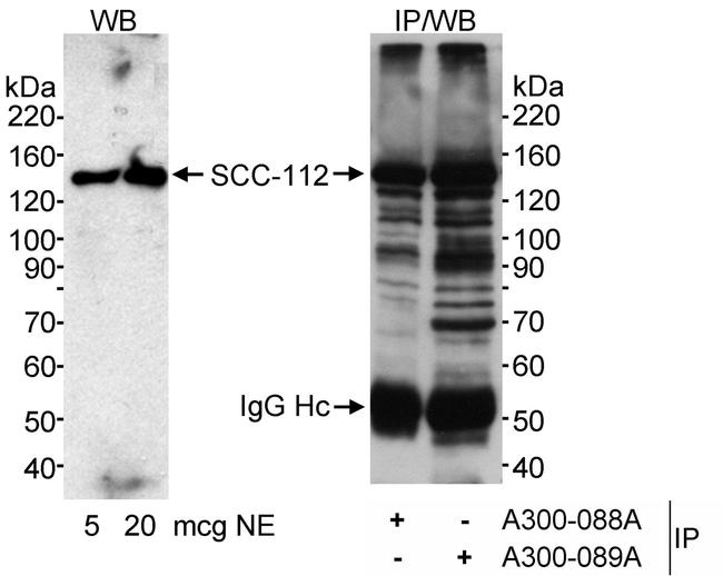 SCC-112 Antibody in Western Blot (WB)