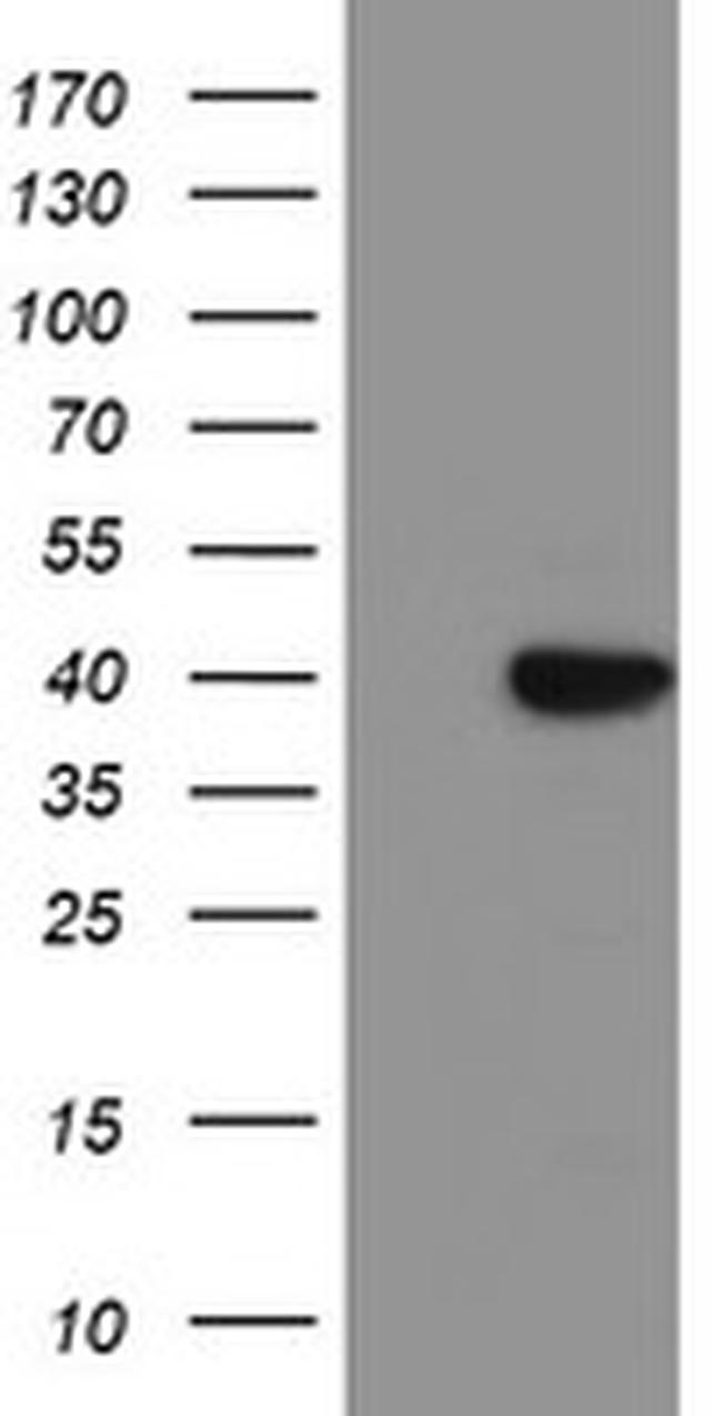 SDS Antibody in Western Blot (WB)