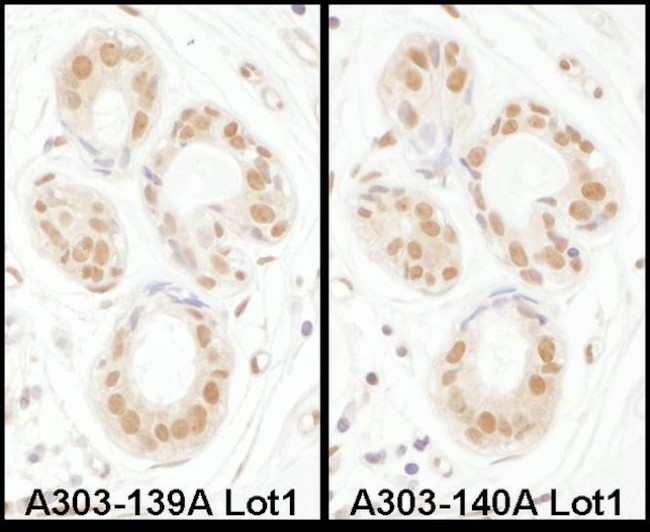 SENP3 Antibody in Immunohistochemistry (IHC)