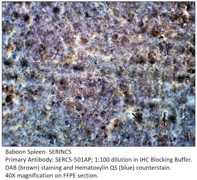 SERINC5 Antibody in Immunohistochemistry (IHC)