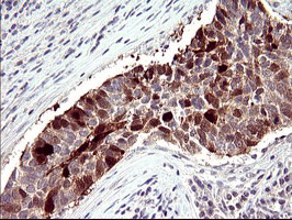 SERPINB3 Antibody in Immunohistochemistry (Paraffin) (IHC (P))