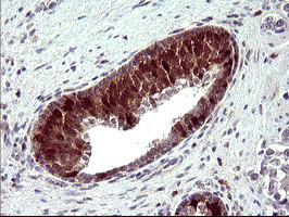 SERPINB3 Antibody in Immunohistochemistry (Paraffin) (IHC (P))