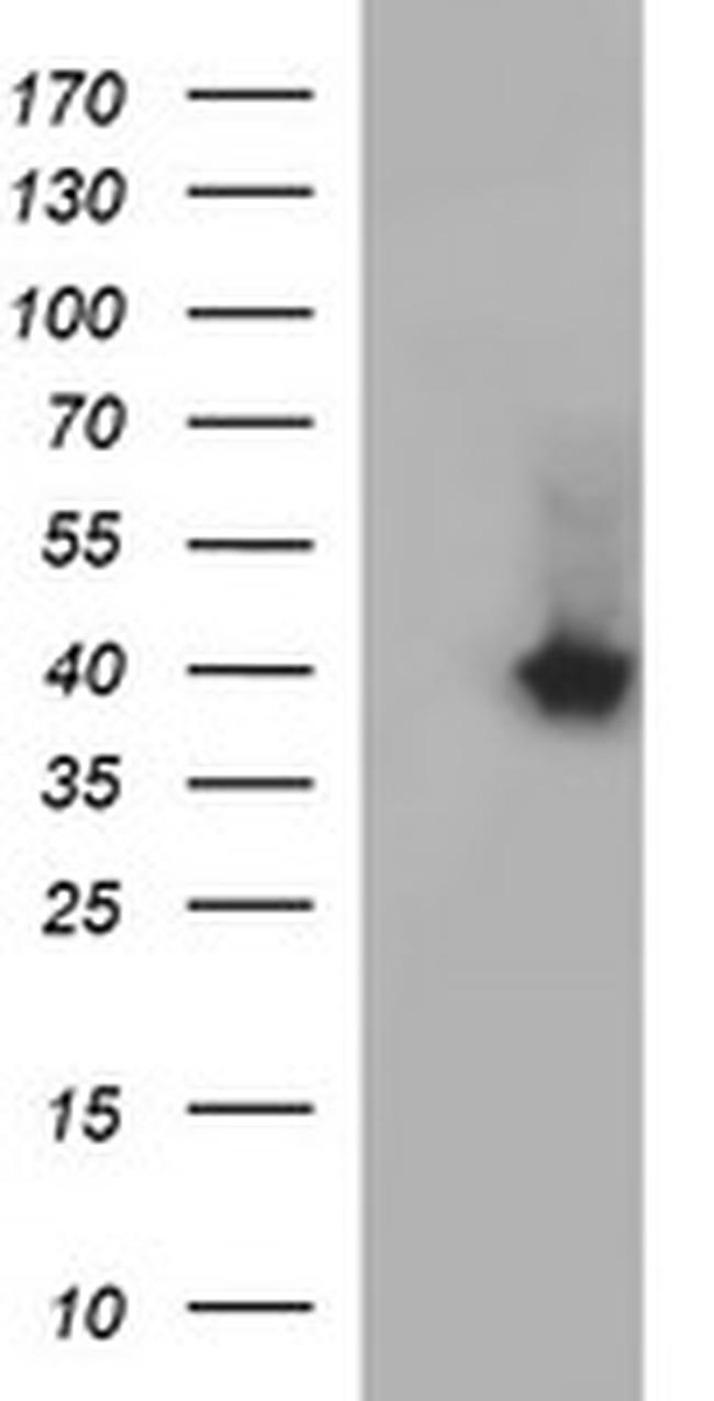 SERPINB3 Antibody in Western Blot (WB)