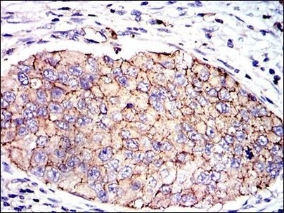 PAI1 Antibody in Immunohistochemistry (Paraffin) (IHC (P))