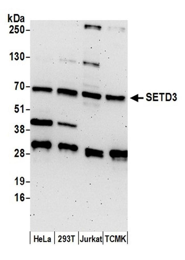 SETD3 Antibody in Western Blot (WB)