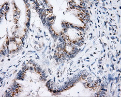 SHC1 Antibody in Immunohistochemistry (Paraffin) (IHC (P))