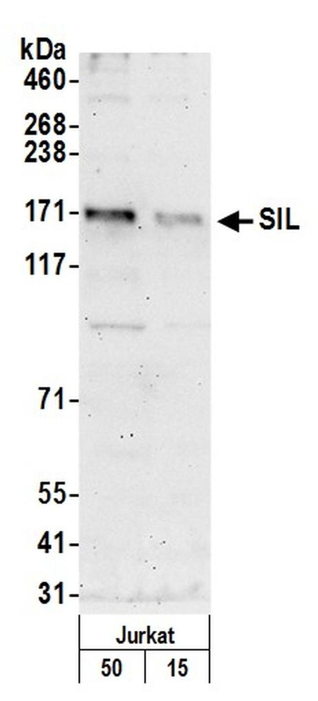 SIL Antibody in Western Blot (WB)