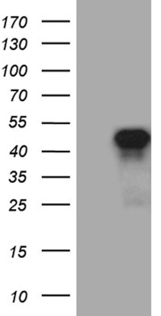 SIX3 Antibody in Western Blot (WB)