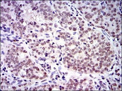 SKP1 Antibody in Immunohistochemistry (Paraffin) (IHC (P))