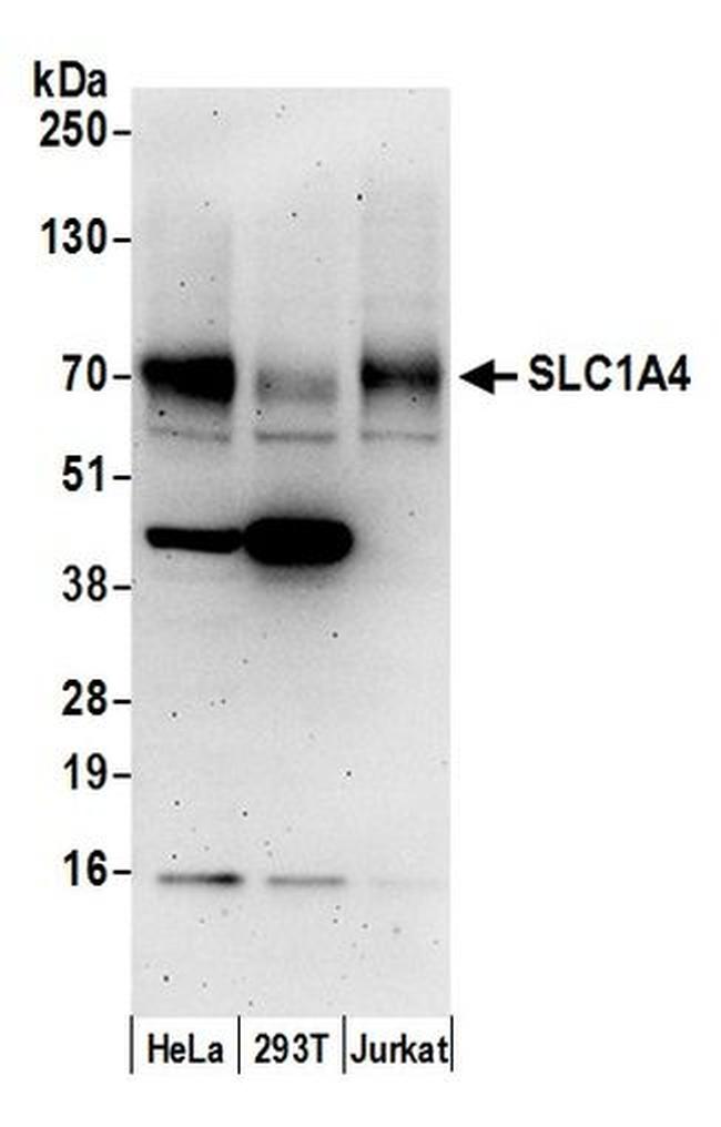 SLC1A4/ASCT1 Antibody in Western Blot (WB)