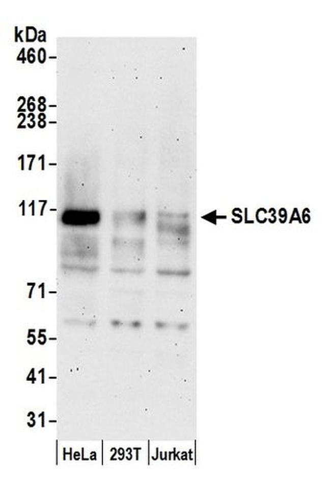 SLC39A6 Antibody in Western Blot (WB)
