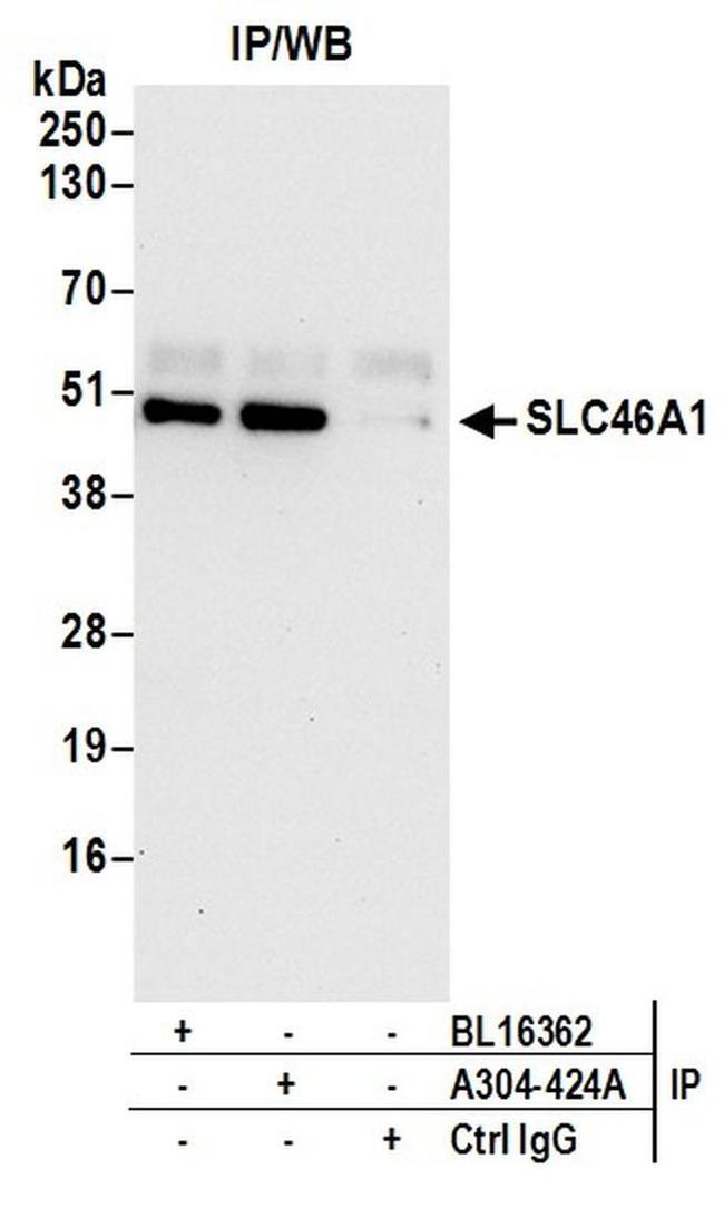 SLC46A1 Antibody in Western Blot (WB)