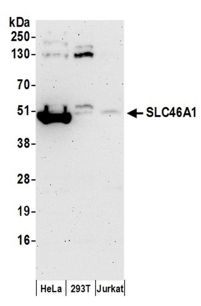 SLC46A1 Antibody in Western Blot (WB)