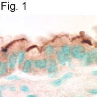 EBP50 Antibody in Immunohistochemistry (IHC)