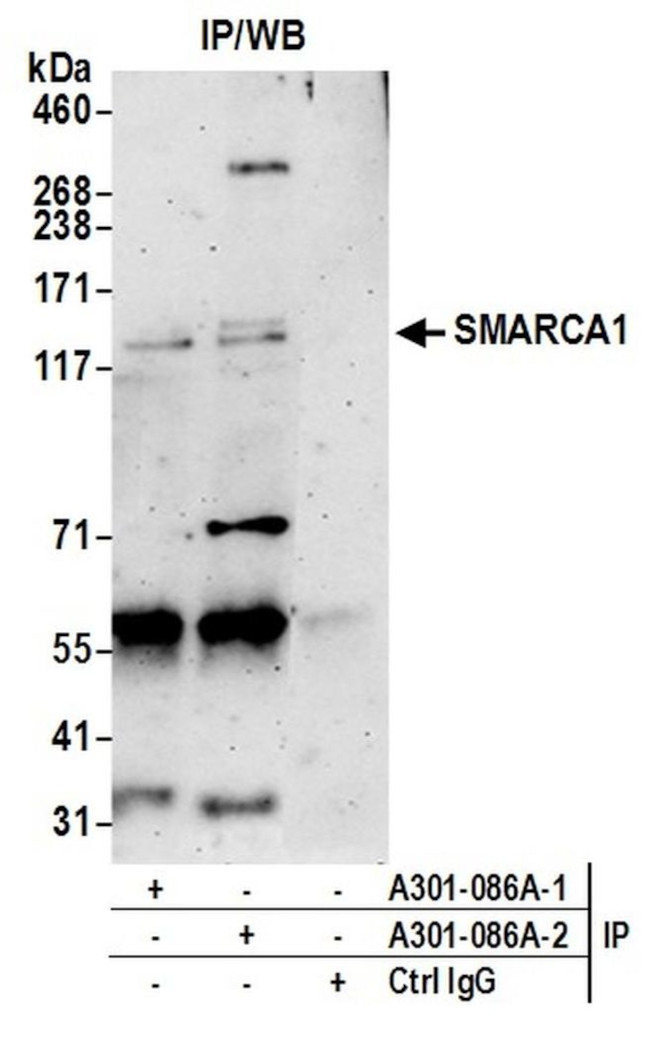 SMARCA1/SNF2L Antibody in Immunoprecipitation (IP)