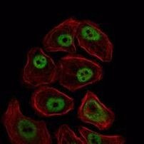 SMC1 Antibody in Immunocytochemistry (ICC/IF)