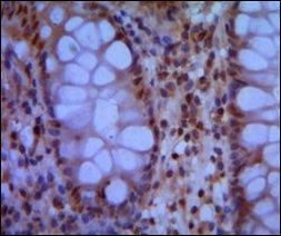 SMC1 Antibody in Immunohistochemistry (Paraffin) (IHC (P))