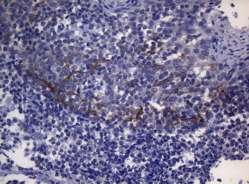 SNX10 Antibody in Immunohistochemistry (Paraffin) (IHC (P))