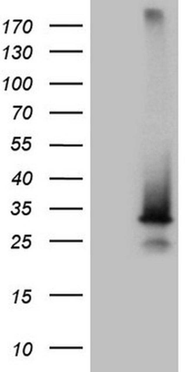 SNX10 Antibody in Western Blot (WB)