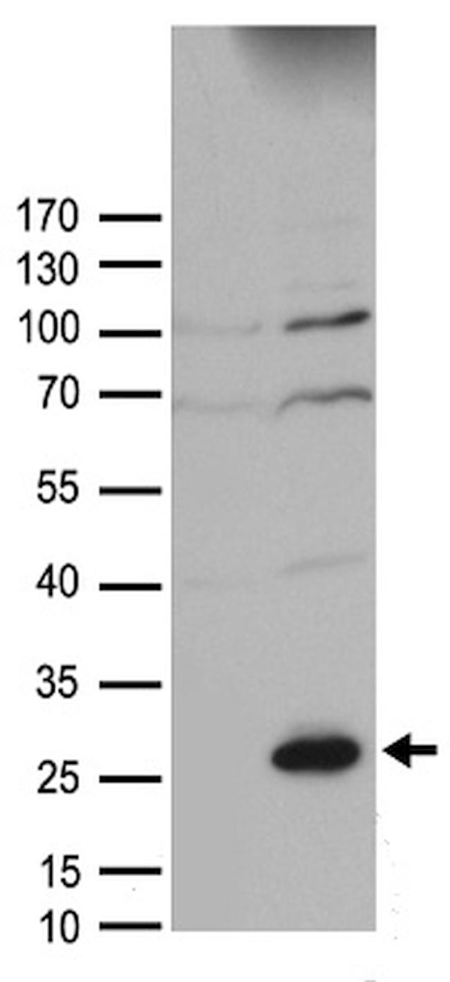 SOCS1 Antibody in Western Blot (WB)