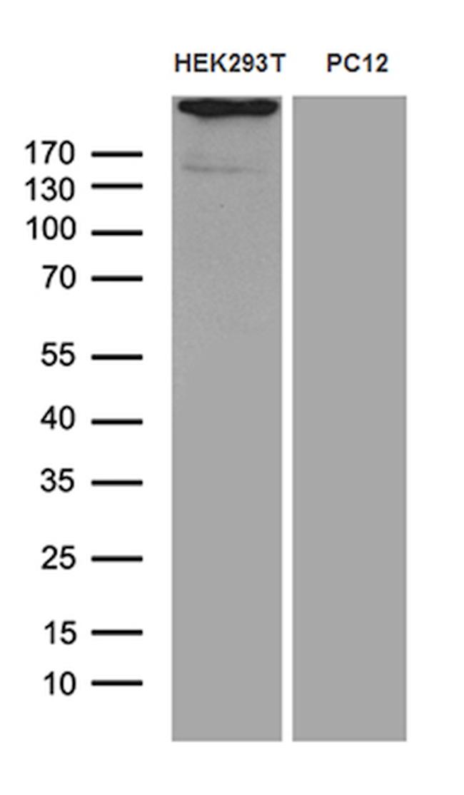 SPAG5 Antibody in Western Blot (WB)
