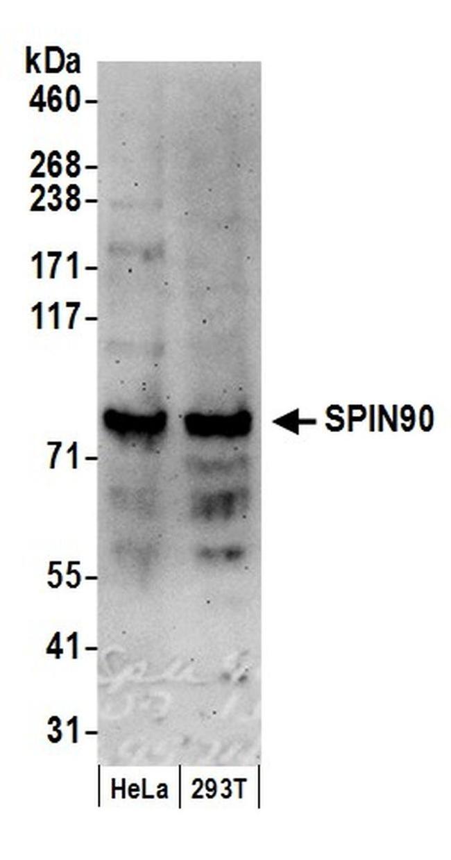 SPIN90 Antibody in Western Blot (WB)