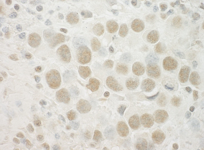 SPIN90 Antibody in Immunohistochemistry (IHC)