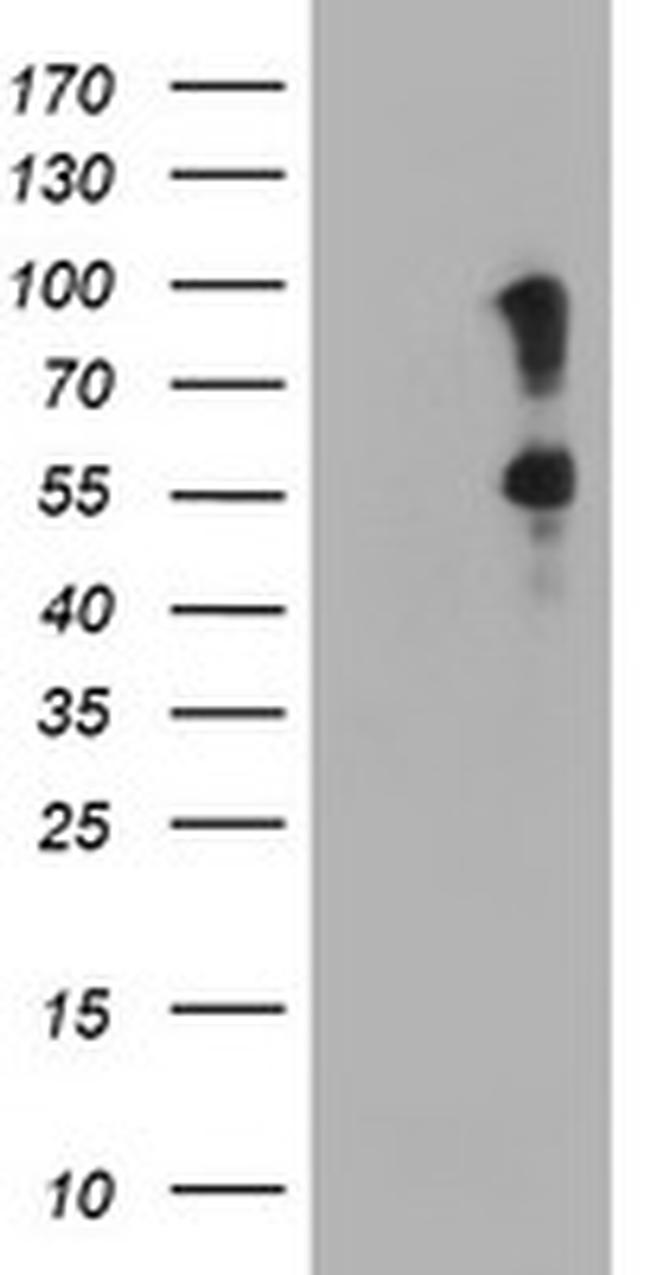 SPINT1 Antibody in Western Blot (WB)