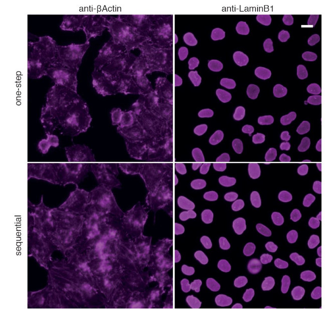 Human IgG/Rabbit IgG VHH Secondary Antibody in Immunocytochemistry (ICC/IF)