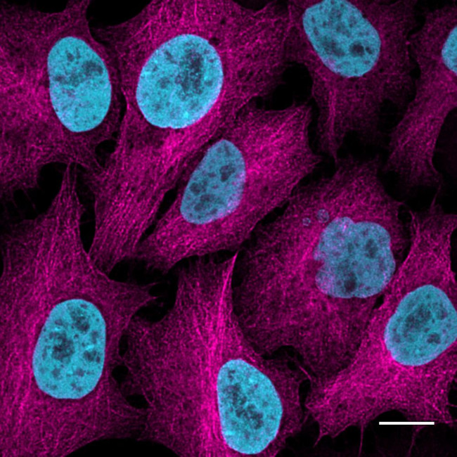 Human IgG/Rabbit IgG VHH Secondary Antibody in Immunocytochemistry (ICC/IF)